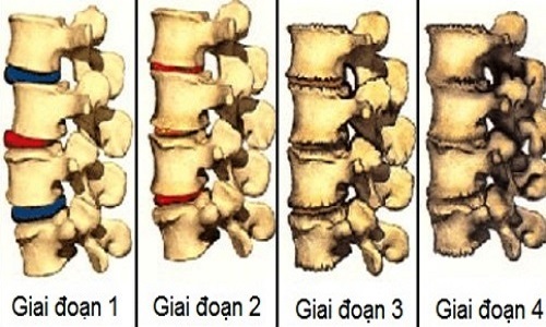 Giai doan thoai hoa