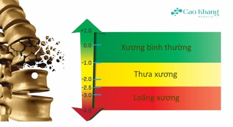 các chỉ số loãng xương