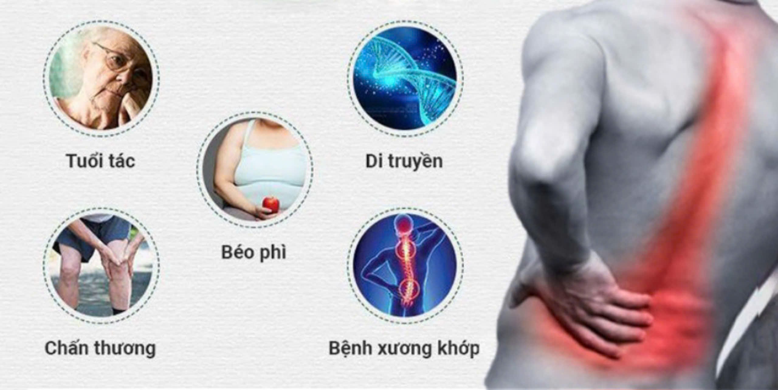 đối tượng thường mắc gai cột sống
