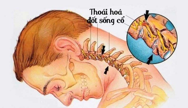 thoai hoa dot song co