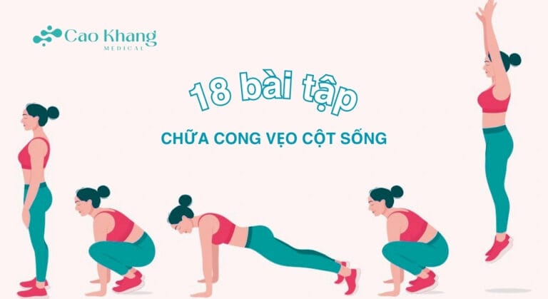 18 bài tập chữa cong vẹo cột sống