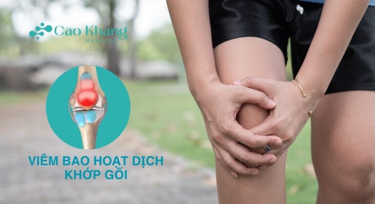 VIÊM BAO HOẠT DỊCH KHỚP GỐI