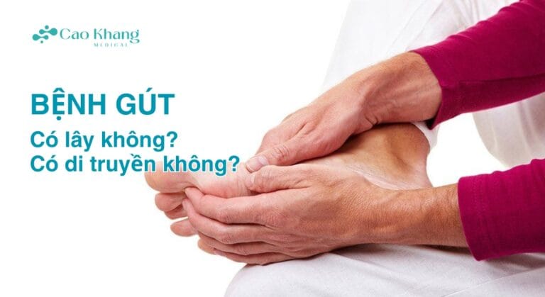 bệnh gút có lây không