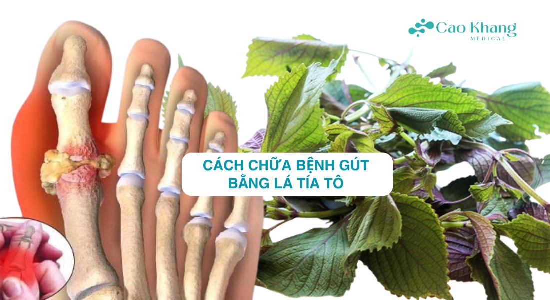 chữa bệnh gút bằng lá tía tô
