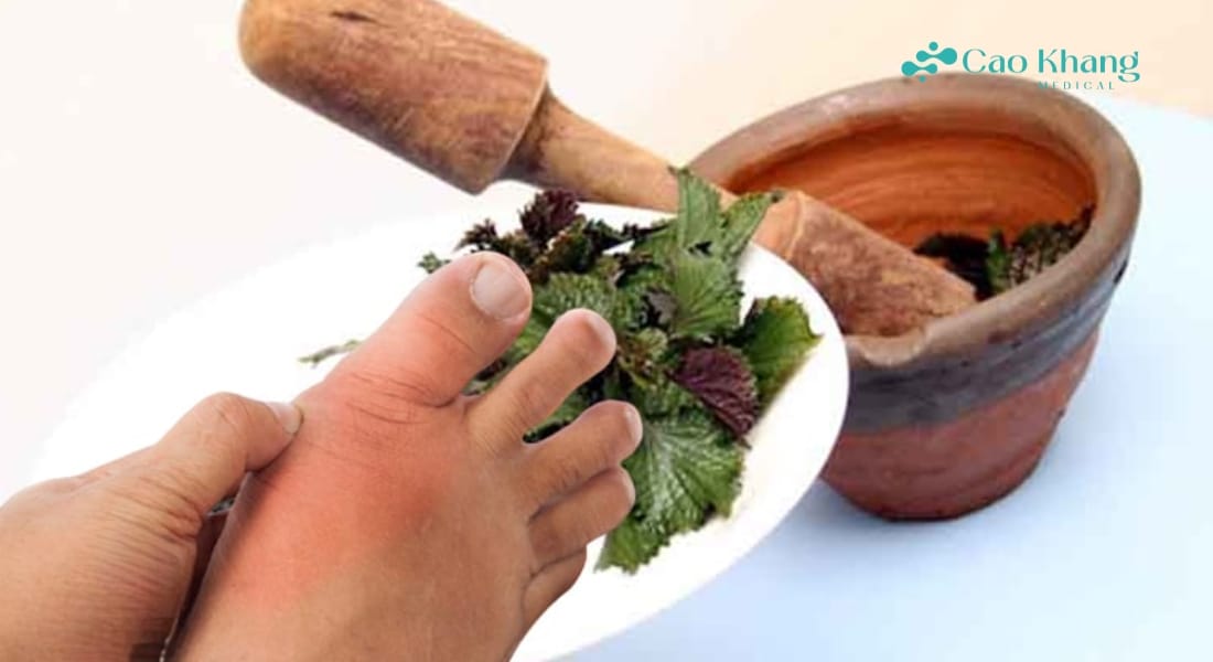 đắp lá tía tô