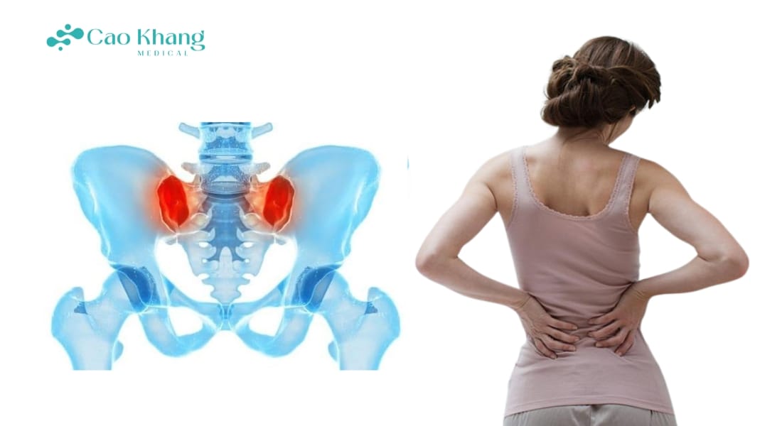 dấu hiệu viêm khớp cùng chậu