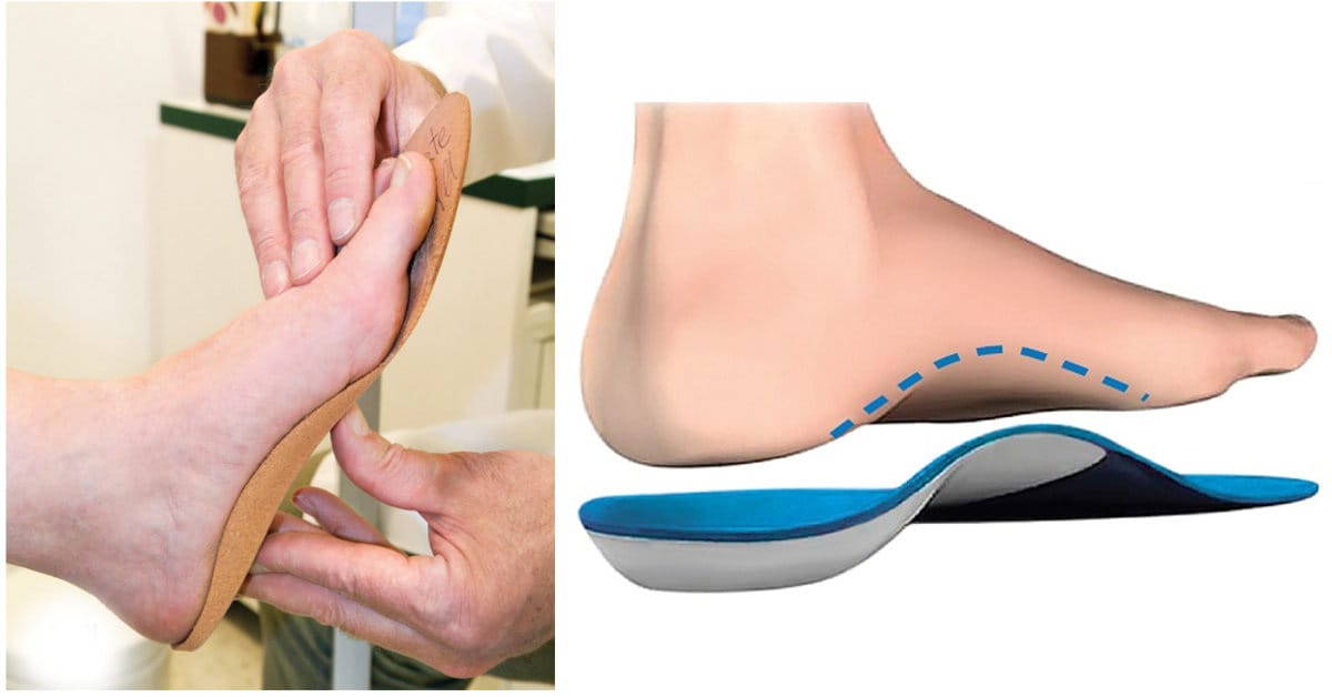 sử dụng giày chỉnh hình