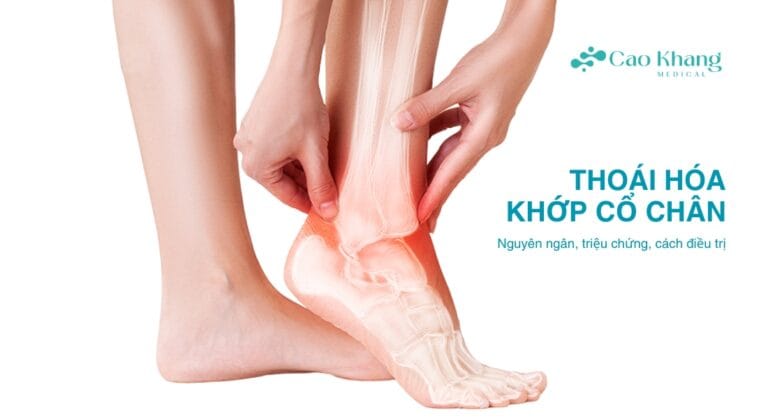 thoái hóa khớp cổ chân