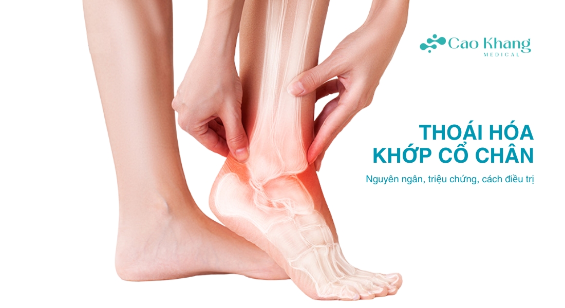 thoái hóa khớp cổ chân