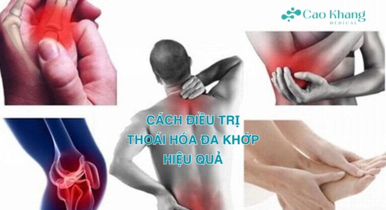 thoái hóa đa khớp