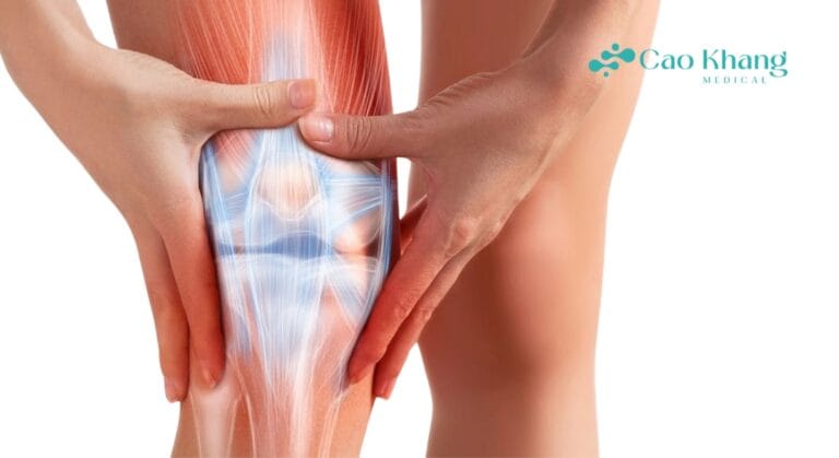 thoái hóa khớp gối