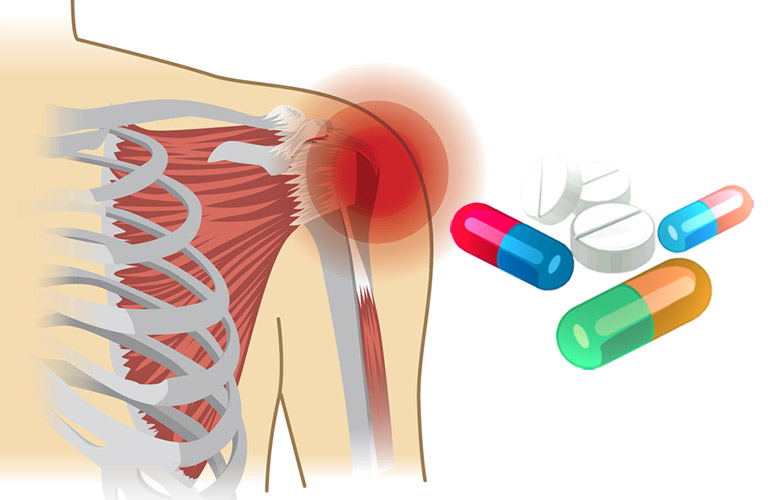 thuốc điều trị viêm khớp vai