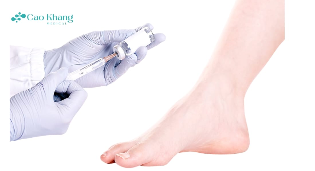 tiêm nội khớp