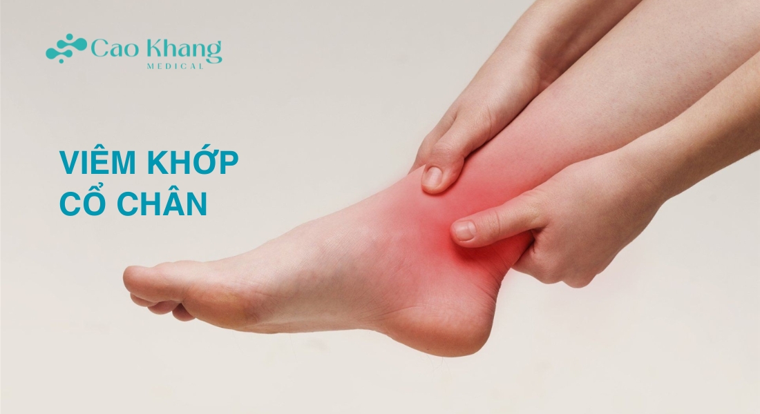 viêm khớp cổ chân