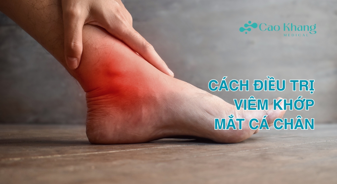 viêm khớp mắt cá chân