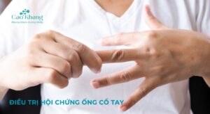 Điều trị hội chứng ống cổ tay (1)