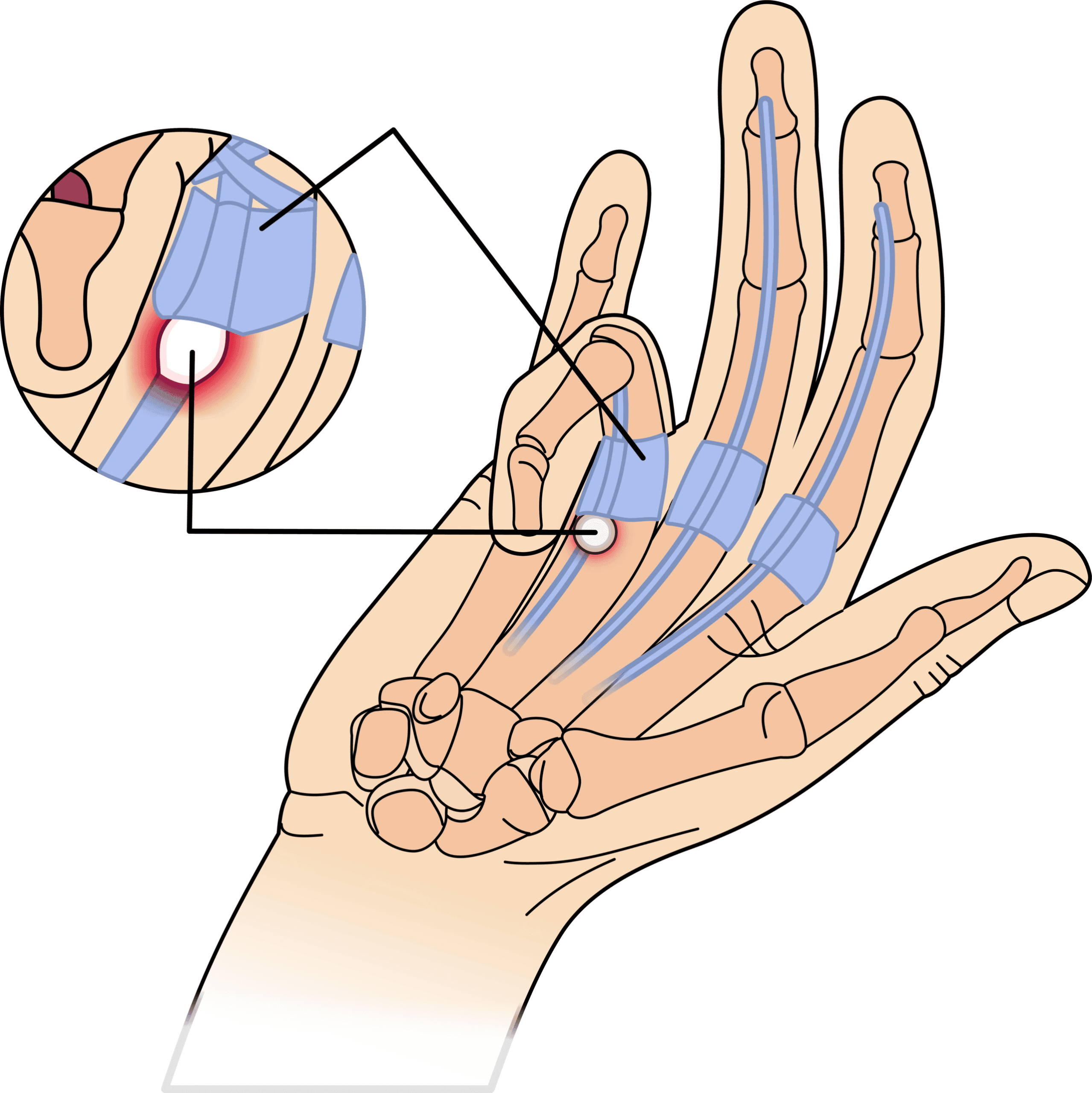Hinh-anh-ngon-tay-co-sung
