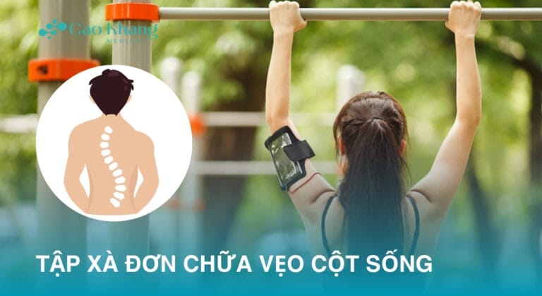 TẬP XÀ ĐƠN CHỮA VẸO CỘT SỐNG