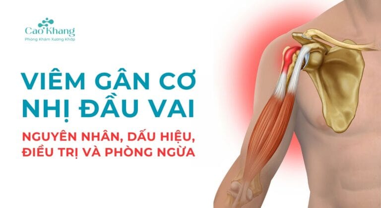 Viêm gân cơ nhị đầu vai