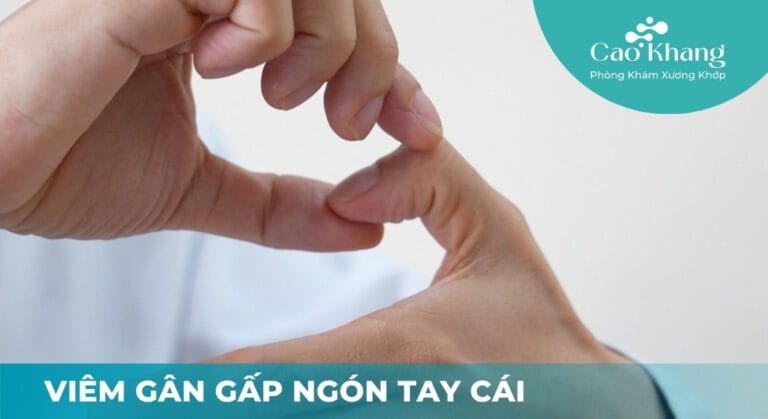 Viêm gân gấp ngón tay cái