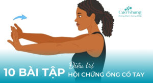 bài tập điều trị hội chứng ống cổ tay