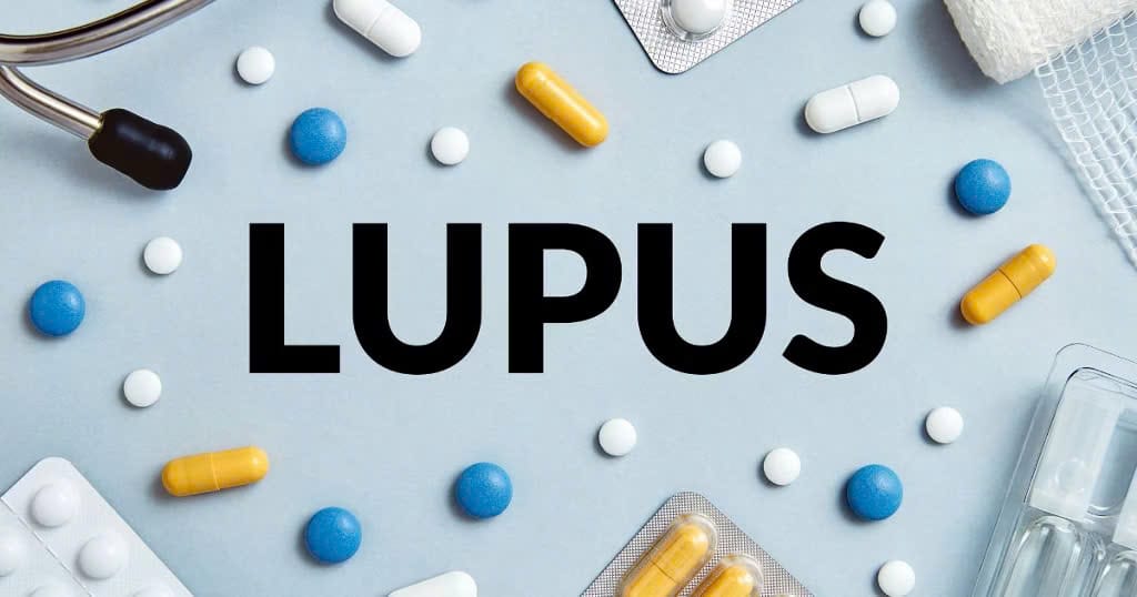 bệnh lupus ban đỏ