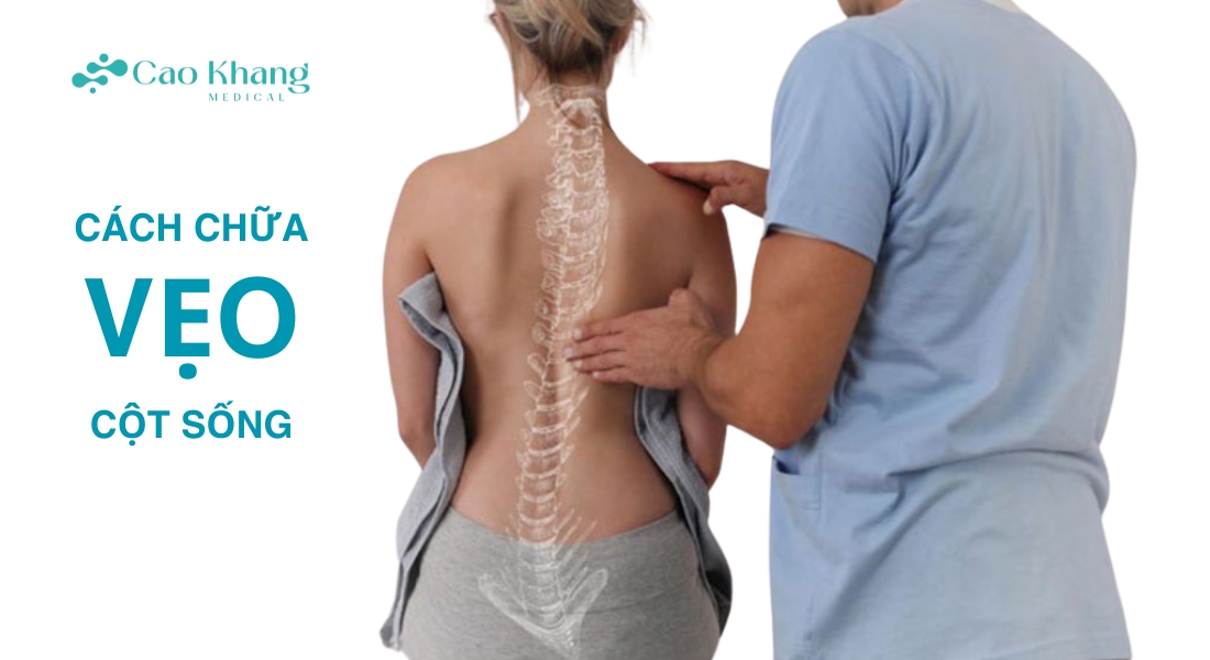 cách chữa vẹo cột sống ở người lớn