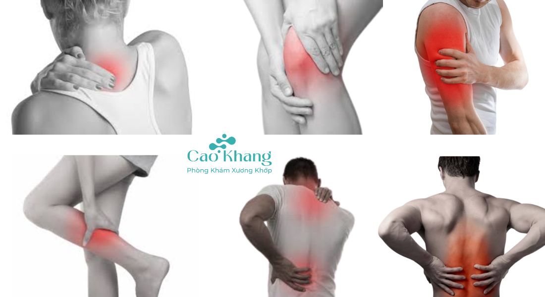 cách giảm đau cơ nhanh chóng