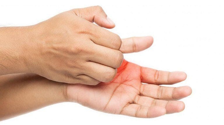 ngứa cổ tay sau mổ