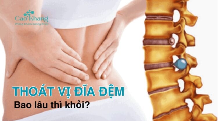 thoát vị đĩa đệm bao lâu thì khỏi