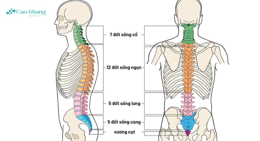 vẹo cột sống ngực