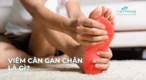 viêm cân gan chân là gì?