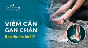viêm cân gan chân bao lâu thì khỏi
