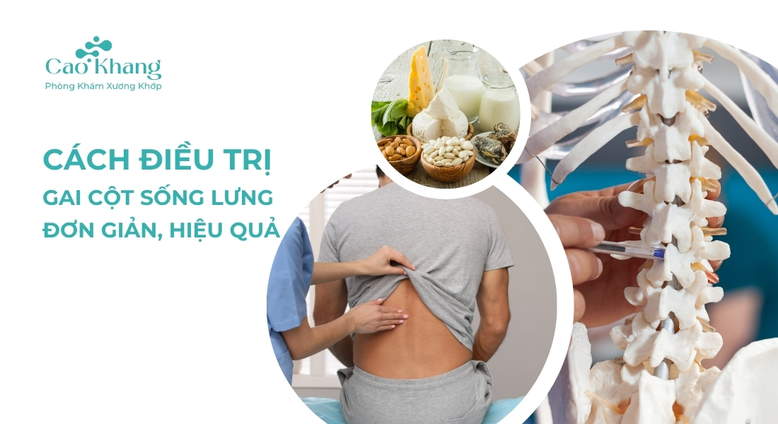 Cách trị gai cột sống lưng tại nhà
