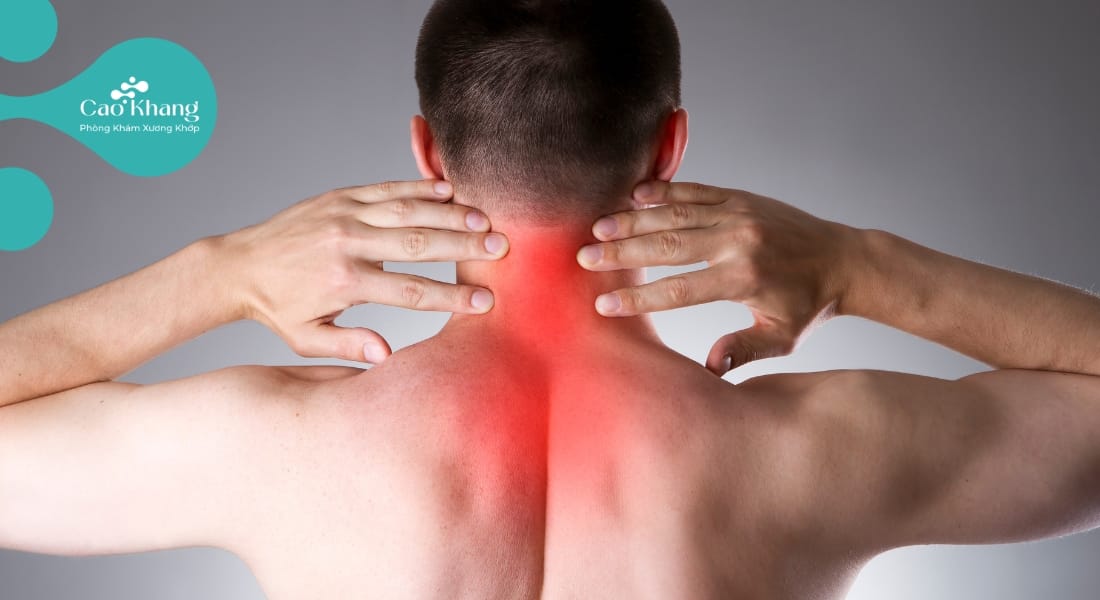 Trật khớp cổ (1)