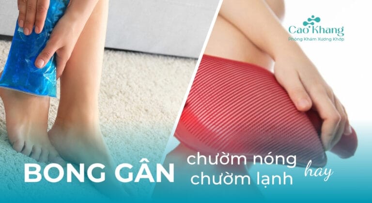 bong gân chườm nóng hay lạnh