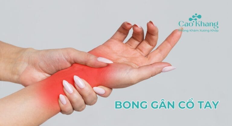 bong gân cổ tay