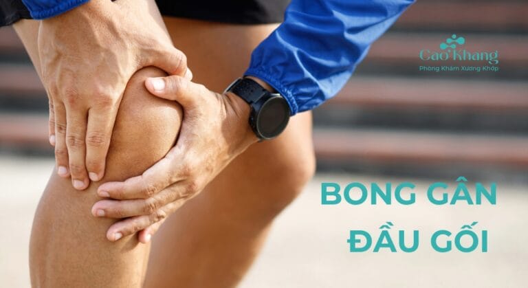 bong gân đầu gối