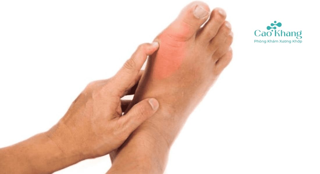 bong gân ngón chân cái