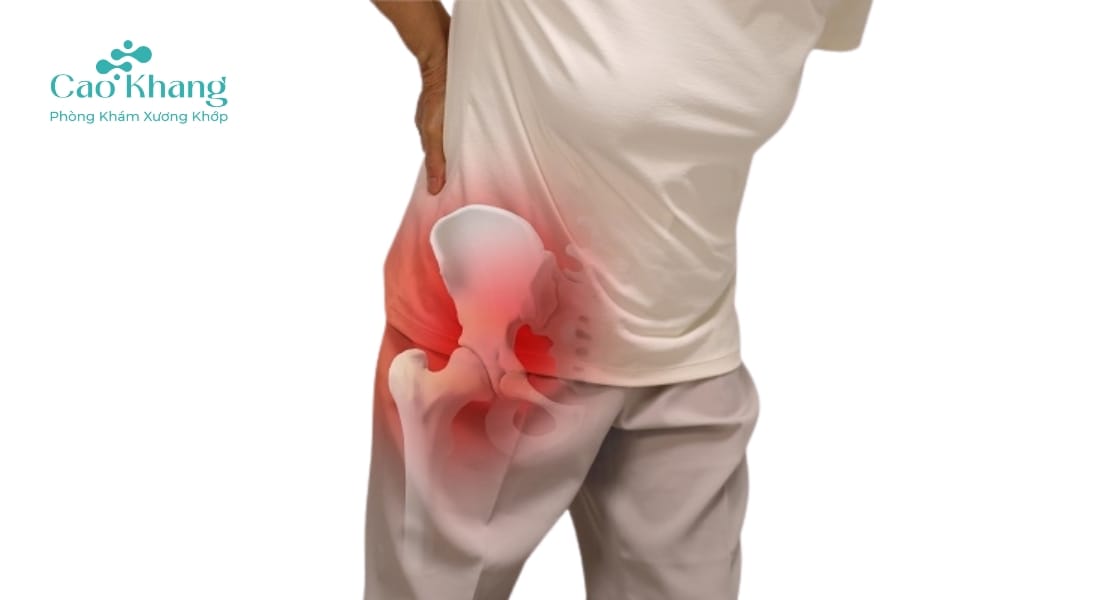 dấu hiệu trật khớp háng
