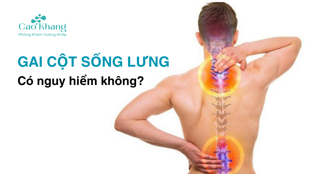 gai cột sống lưng có nguy hiểm không