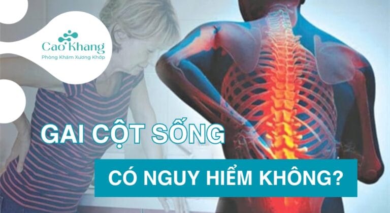gia cột sống có nguy hiểm không