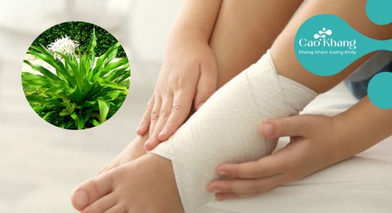 mẹo chữa bong gân