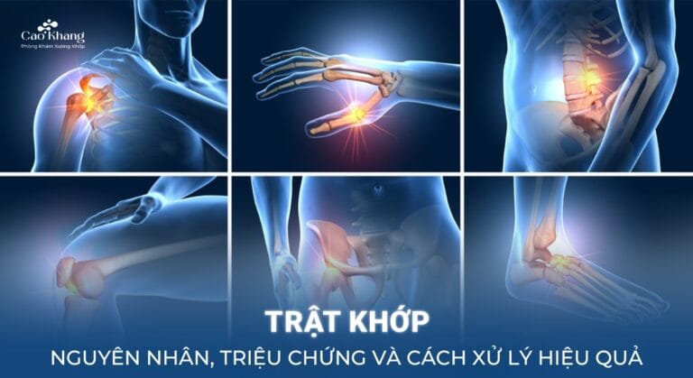 trật khớp