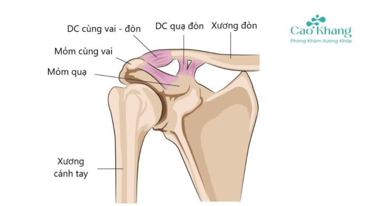 trật khớp cùng đòn