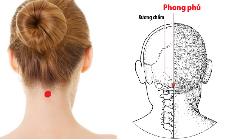 bấm huyệt đau vai gáy: Huyệt Phong phủ