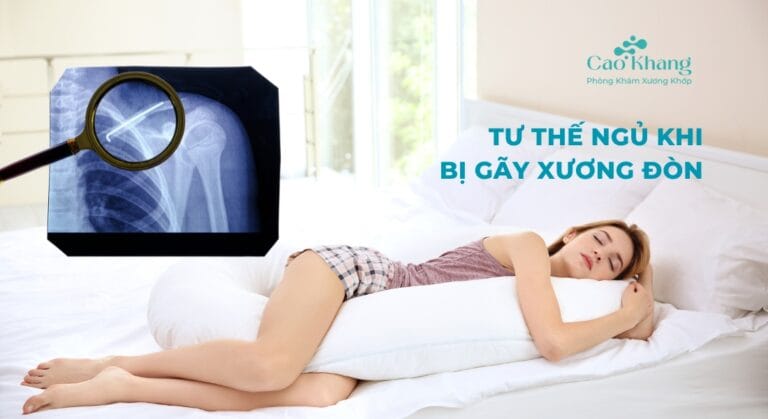 Tư thế ngủ khi bị gãy xương đòn