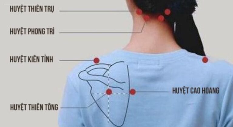 bấm huyệt đau vai gáy