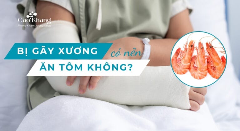 bị gãy xương có nên ăn tôm không