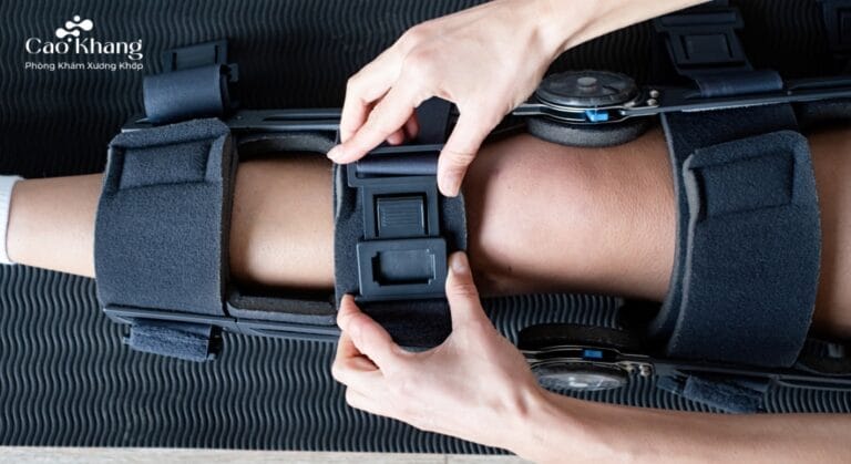 các loại nẹp cố định gãy xương